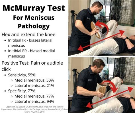 mcmurray test results